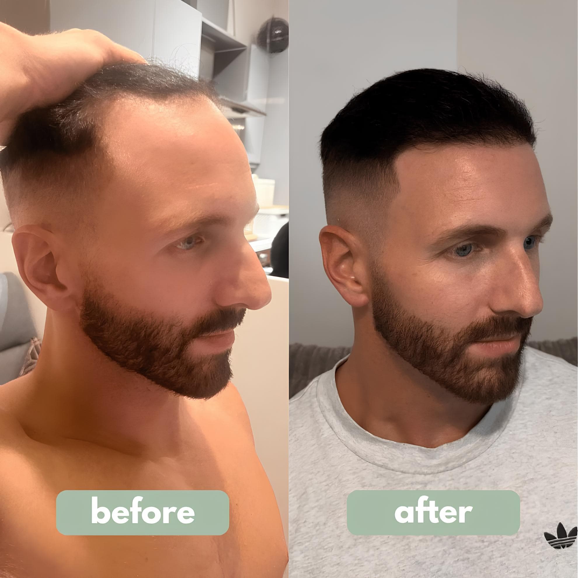 Sqise - Hair Growth Serum