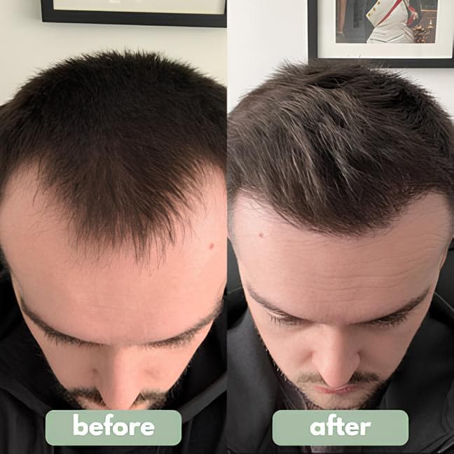 Sqise - Hair Growth Serum